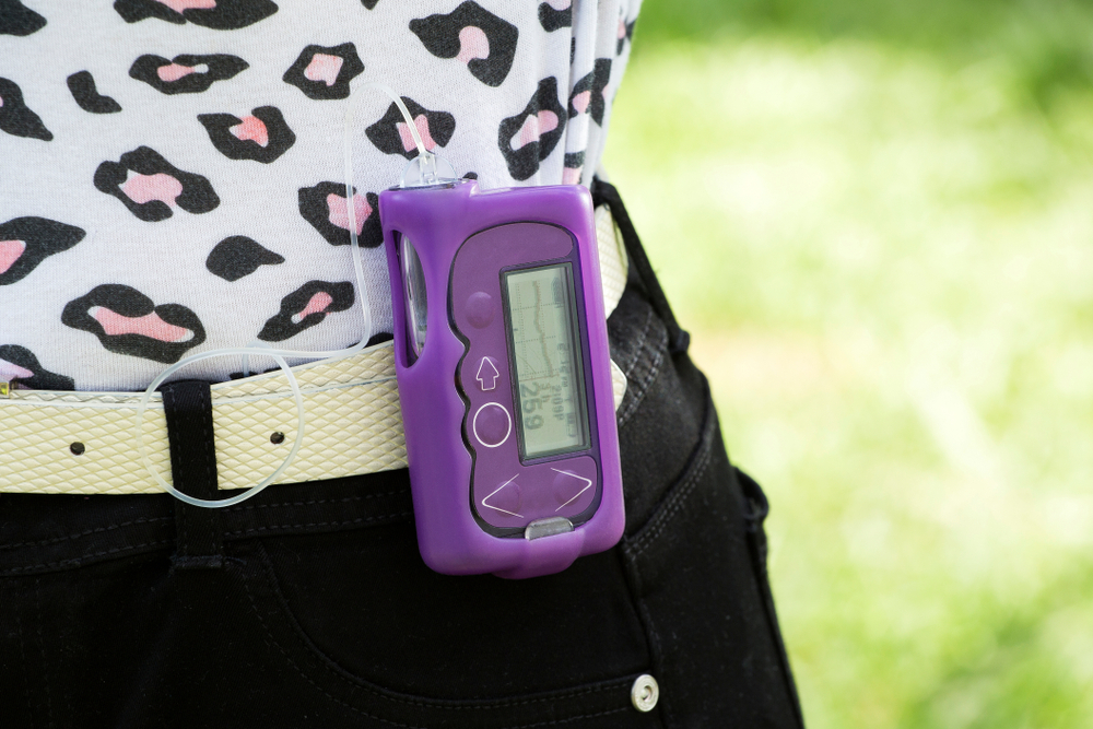 Person wearing an insulin pump on their belt.