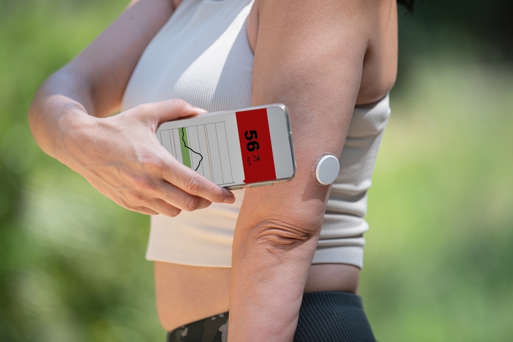 A runner uses a CGM to monitor blood sugar levels