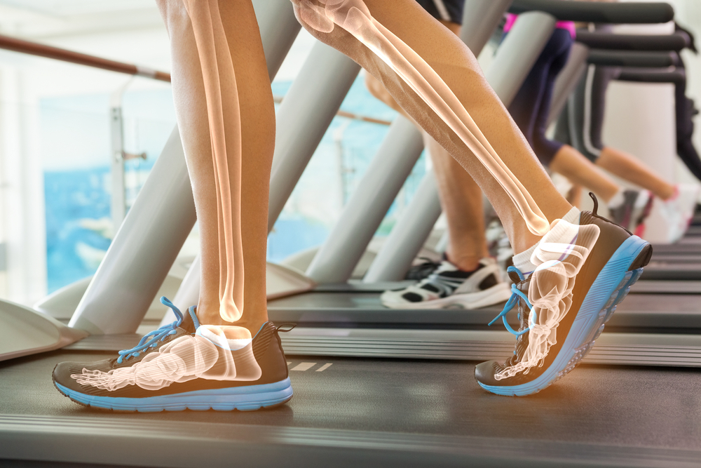Person walking on a treadmill