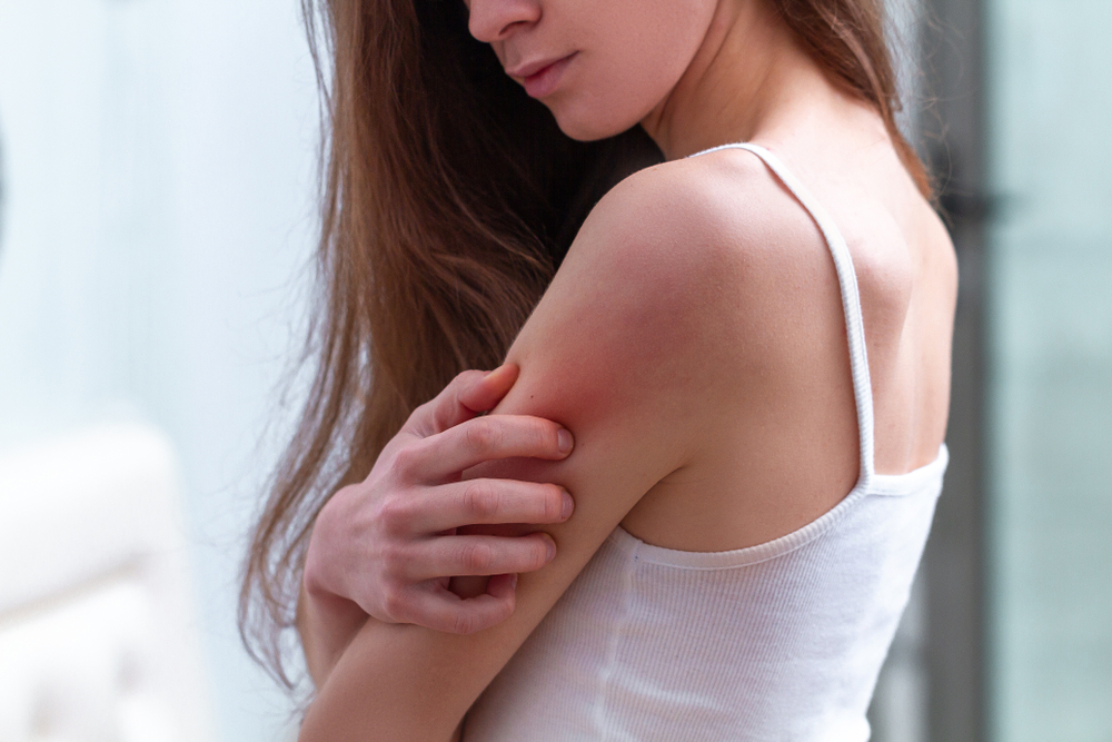 A woman rubs her arm due to skin irritation